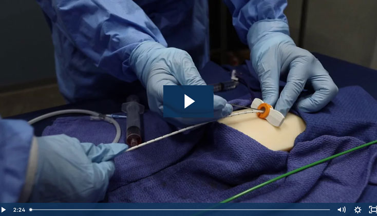 Impella® Skills Video: Single-Access Technique for Impella CP® and Impella CP® with SmartAssist®
