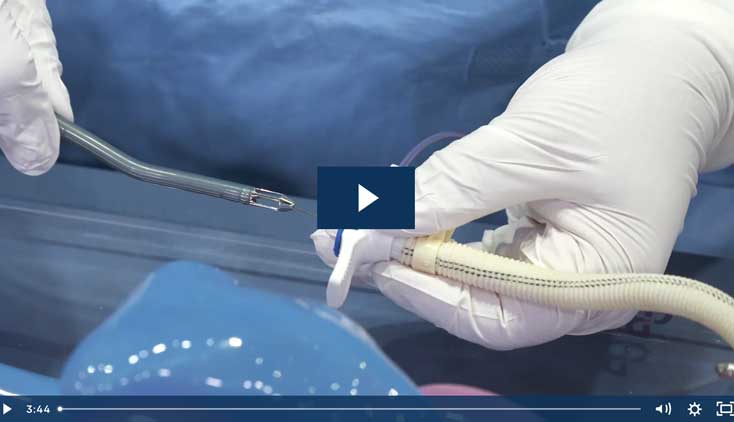 Impella® Skills Video: Impella 5.5® with SmartAssist® Insertion with Axillary Insertion Kit