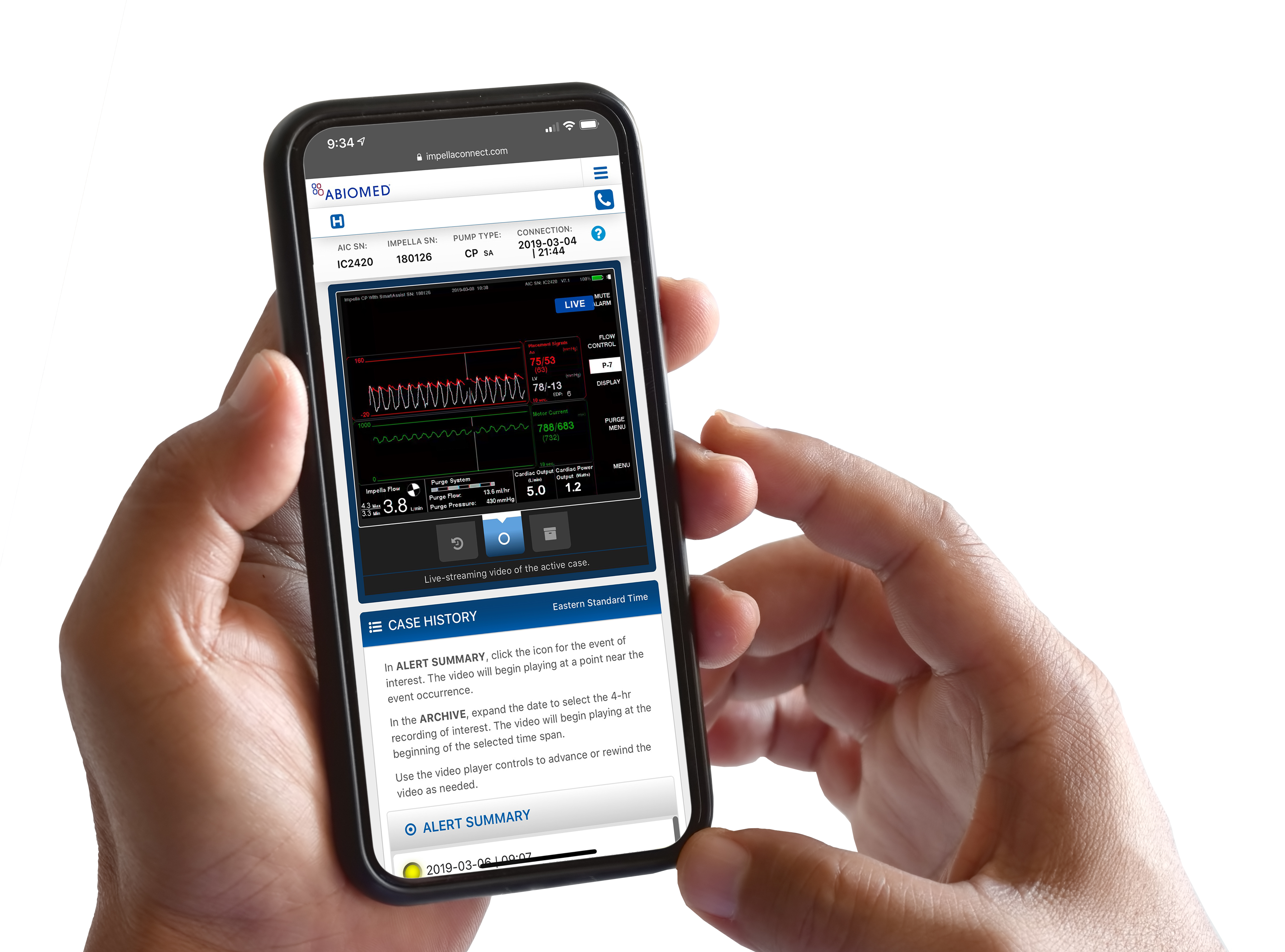 Impella Connect® screen being shown on a smartphone