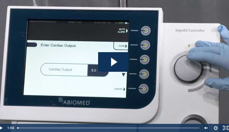 Impella® Skills Video: Entering Cardiac Output
